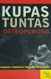 Kupas tuntas osteoporosis
